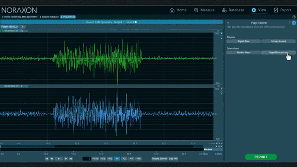 点选即可信号处理